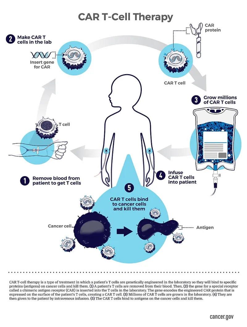 The CAR-T Paradox: A Cure in the Clinic, a Crisis in the Supply Chain